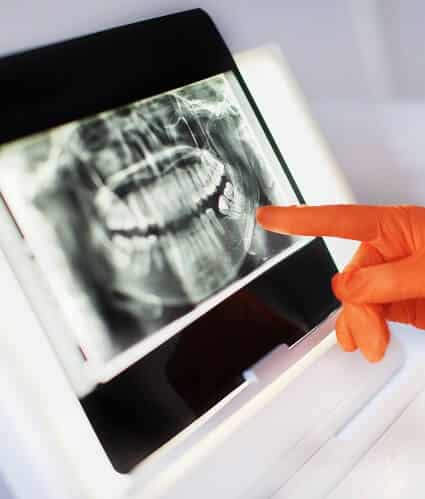 pointing-at-dental-technology